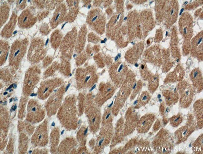 Perilipin 5 Antibody in Immunohistochemistry (Paraffin) (IHC (P))