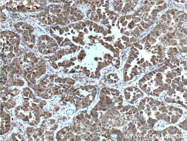 Bcl-XL Antibody in Immunohistochemistry (Paraffin) (IHC (P))