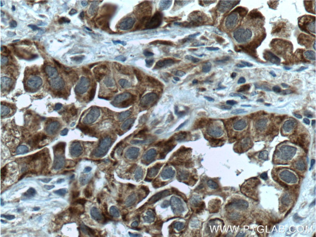 Bcl-XL Antibody in Immunohistochemistry (Paraffin) (IHC (P))