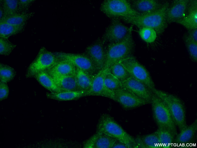 Bcl-XL Antibody in Immunocytochemistry (ICC/IF)