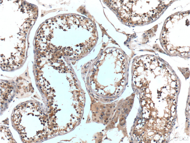 Bcl-XL Antibody in Immunohistochemistry (Paraffin) (IHC (P))