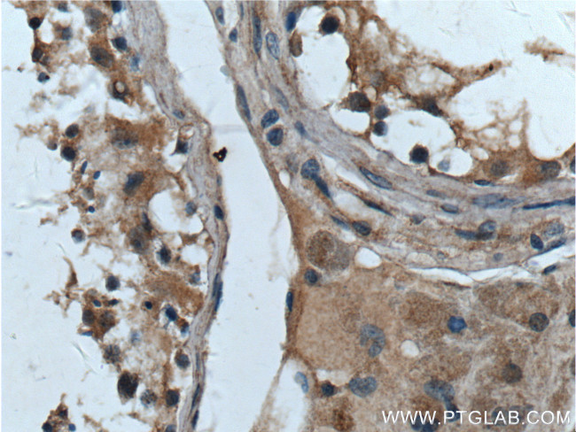 Bcl-XL Antibody in Immunohistochemistry (Paraffin) (IHC (P))