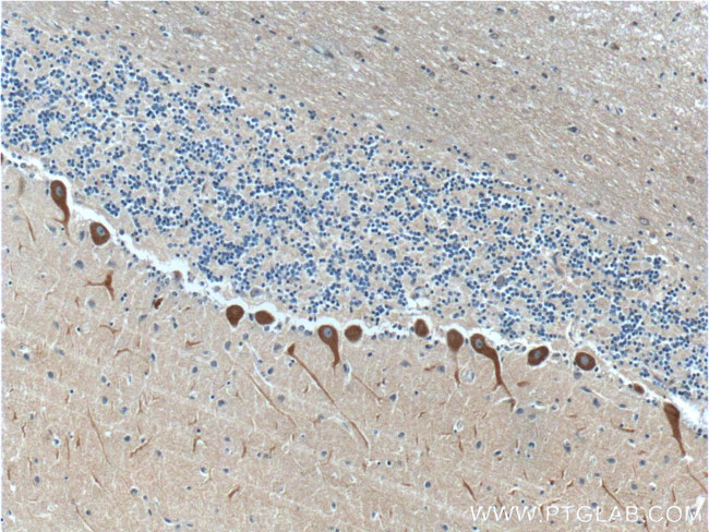 RYR1 Antibody in Immunohistochemistry (Paraffin) (IHC (P))