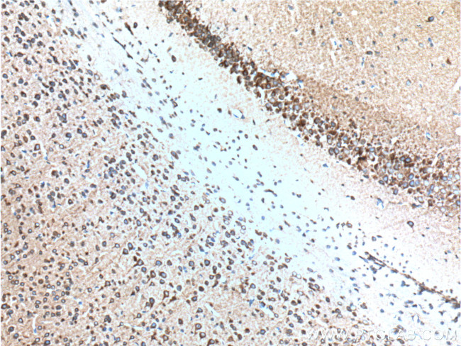 RYR1 Antibody in Immunohistochemistry (Paraffin) (IHC (P))