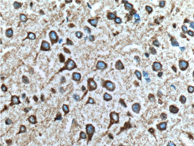 RYR1 Antibody in Immunohistochemistry (Paraffin) (IHC (P))