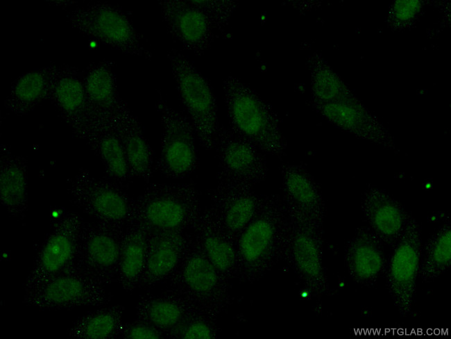 DNMT3B Antibody in Immunocytochemistry (ICC/IF)