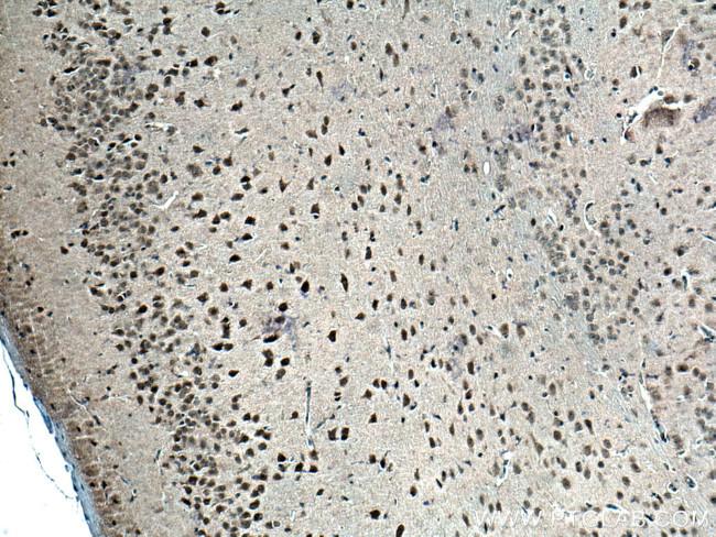 DNMT3B Antibody in Immunohistochemistry (Paraffin) (IHC (P))