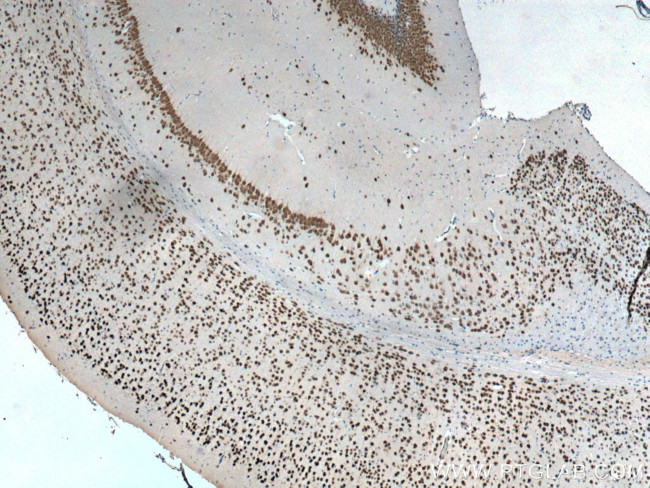 NeuN Antibody in Immunohistochemistry (Paraffin) (IHC (P))