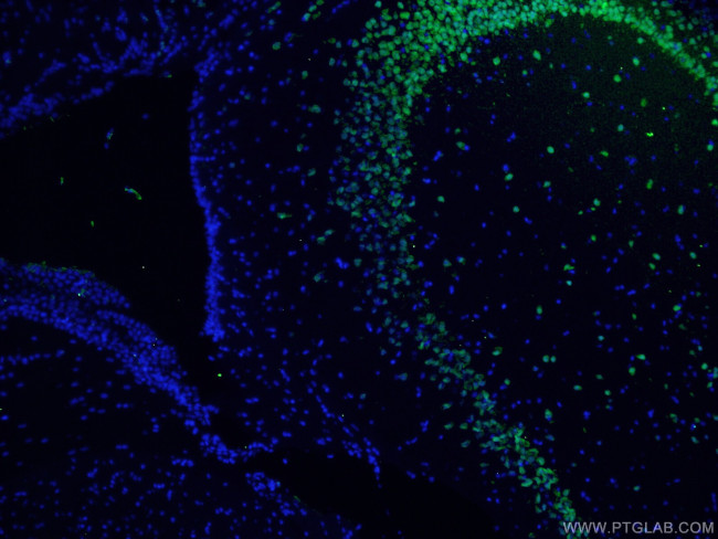 NeuN Antibody in Immunohistochemistry (PFA fixed) (IHC (PFA))