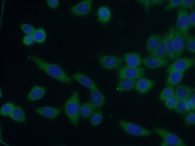 DCDC2 Antibody in Immunocytochemistry (ICC/IF)