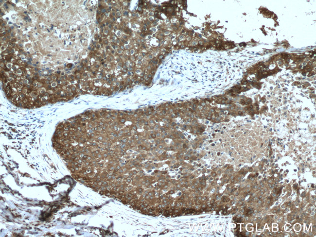 DCDC2 Antibody in Immunohistochemistry (Paraffin) (IHC (P))