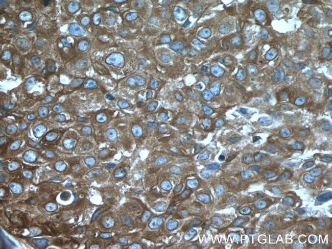 DCDC2 Antibody in Immunohistochemistry (Paraffin) (IHC (P))