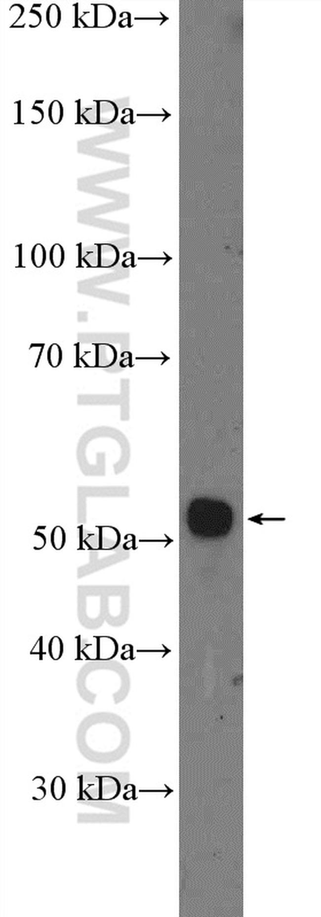 DCDC2 Antibody in Western Blot (WB)