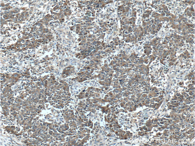 LCN2 Antibody in Immunohistochemistry (Paraffin) (IHC (P))