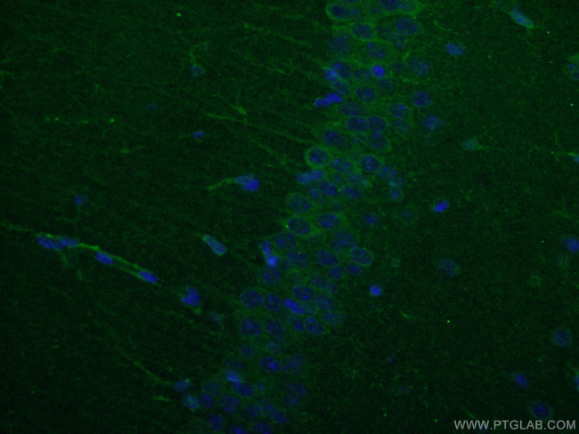 WFS1 Antibody in Immunohistochemistry (Paraffin) (IHC (P))