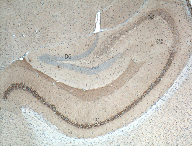 WFS1 Antibody in Immunohistochemistry (Paraffin) (IHC (P))