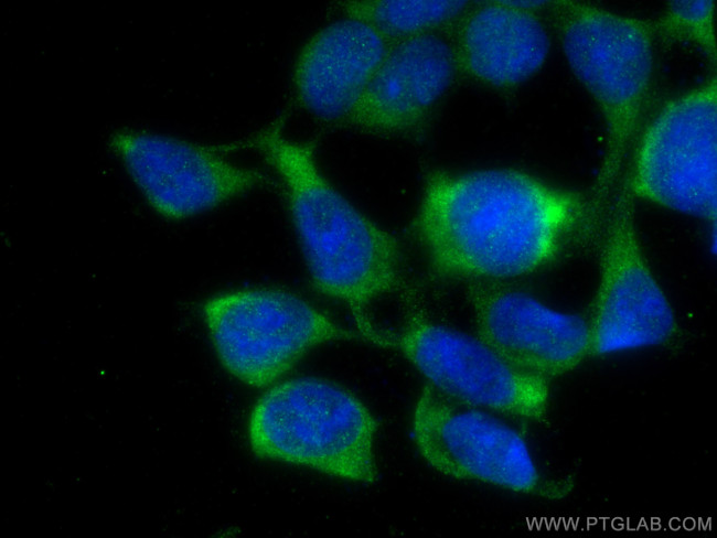 CITED1 Antibody in Immunocytochemistry (ICC/IF)