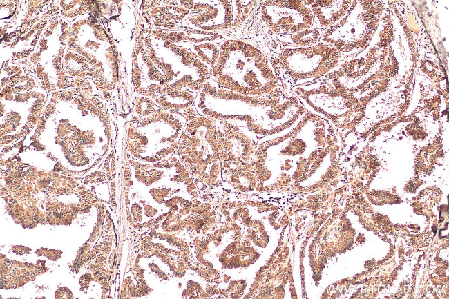 CITED1 Antibody in Immunohistochemistry (Paraffin) (IHC (P))