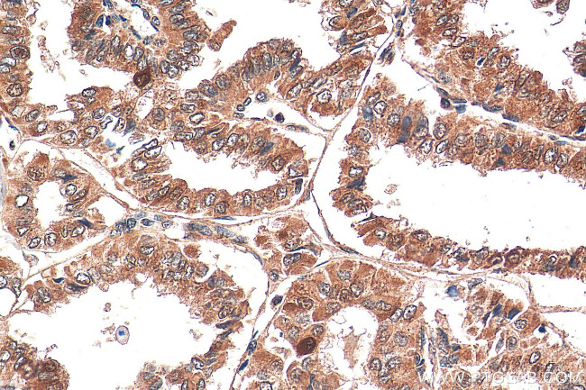 CITED1 Antibody in Immunohistochemistry (Paraffin) (IHC (P))