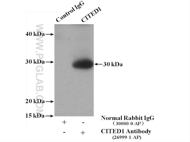 CITED1 Antibody in Immunoprecipitation (IP)