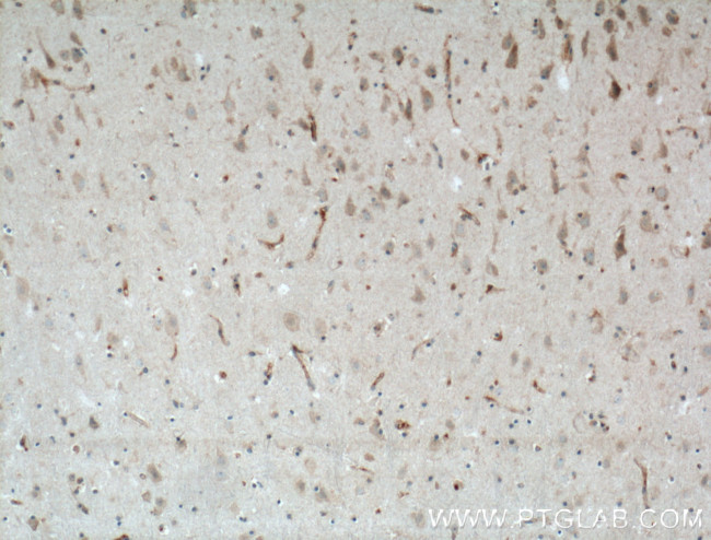 LRRTM3 Antibody in Immunohistochemistry (Paraffin) (IHC (P))