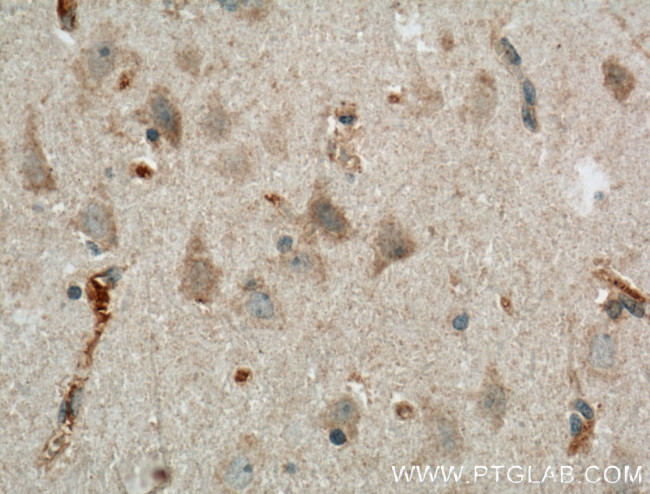 LRRTM3 Antibody in Immunohistochemistry (Paraffin) (IHC (P))