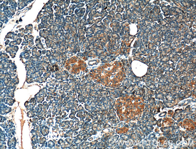 CRELD2 Antibody in Immunohistochemistry (Paraffin) (IHC (P))