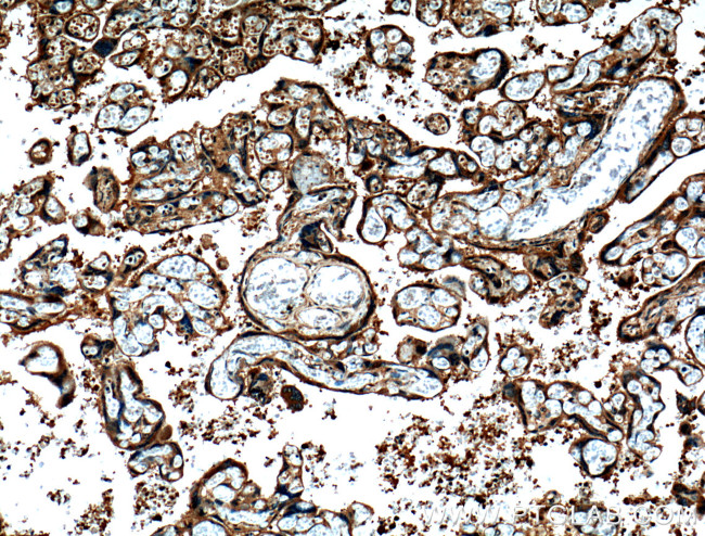 CRELD2 Antibody in Immunohistochemistry (Paraffin) (IHC (P))