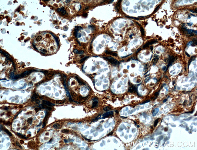 CRELD2 Antibody in Immunohistochemistry (Paraffin) (IHC (P))