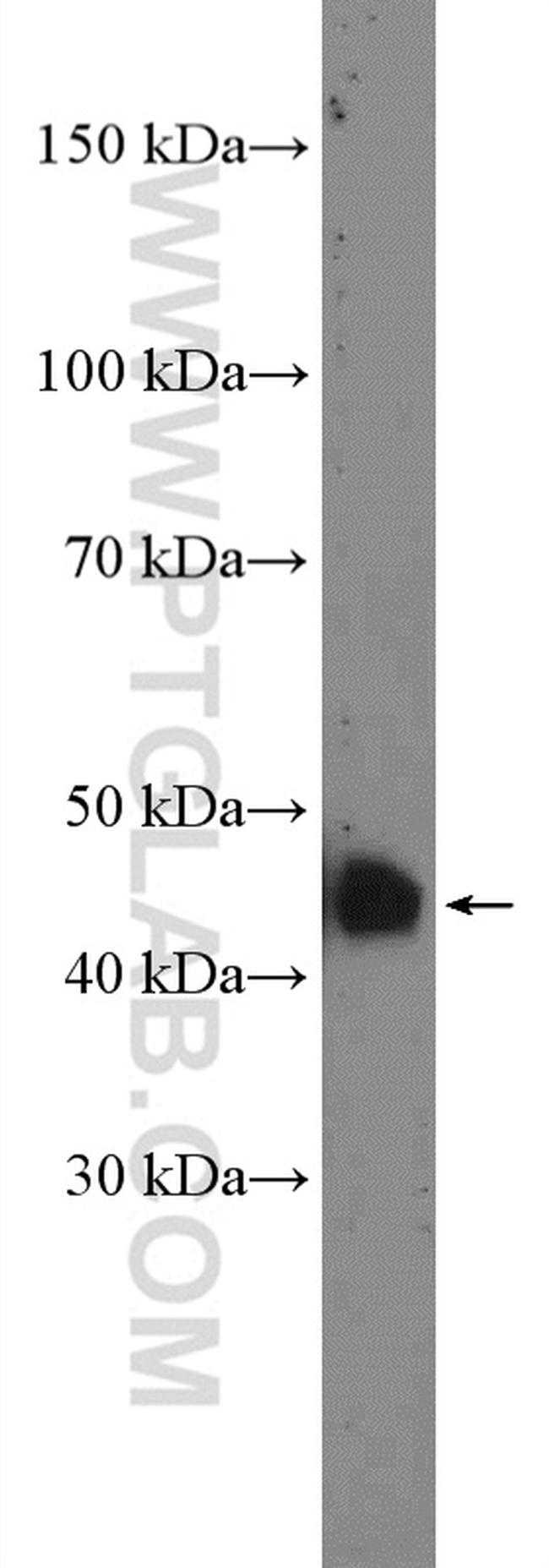 CRELD2 Antibody in Western Blot (WB)