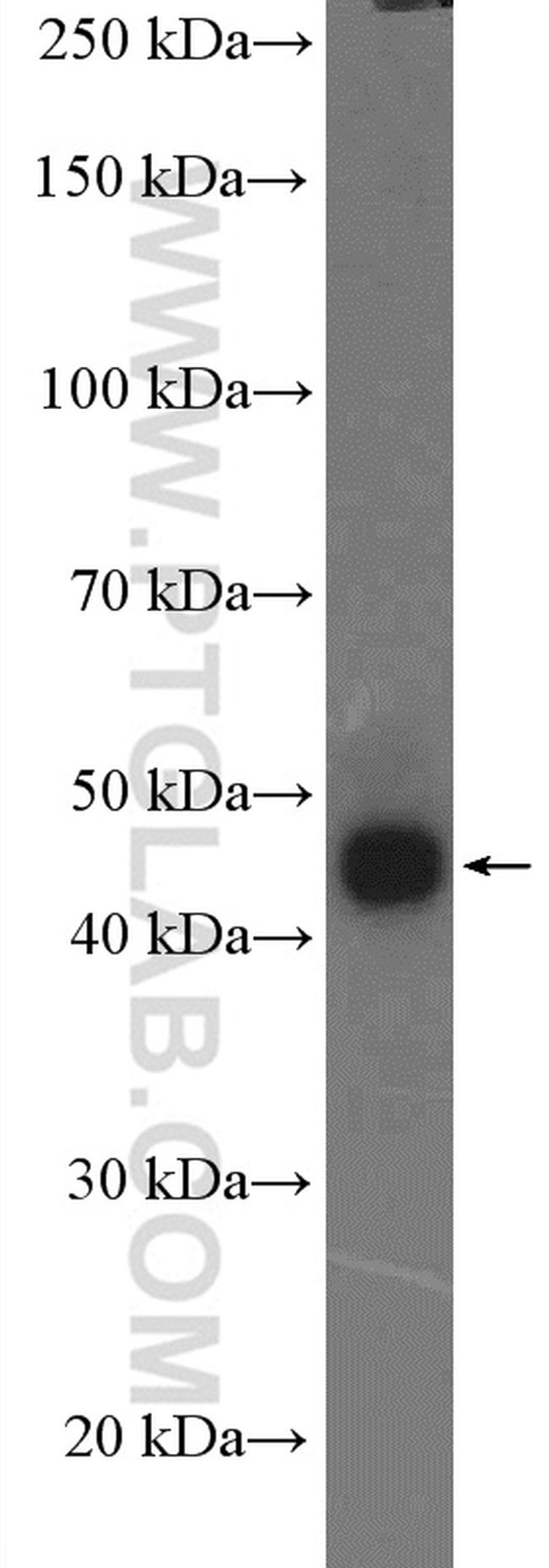 CRELD2 Antibody in Western Blot (WB)