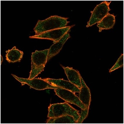 FOXB1 (Transcription Factor) Antibody in Immunocytochemistry (ICC/IF)