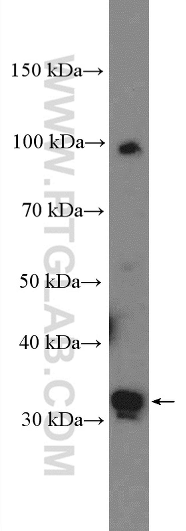 PRPS2 Antibody in Western Blot (WB)