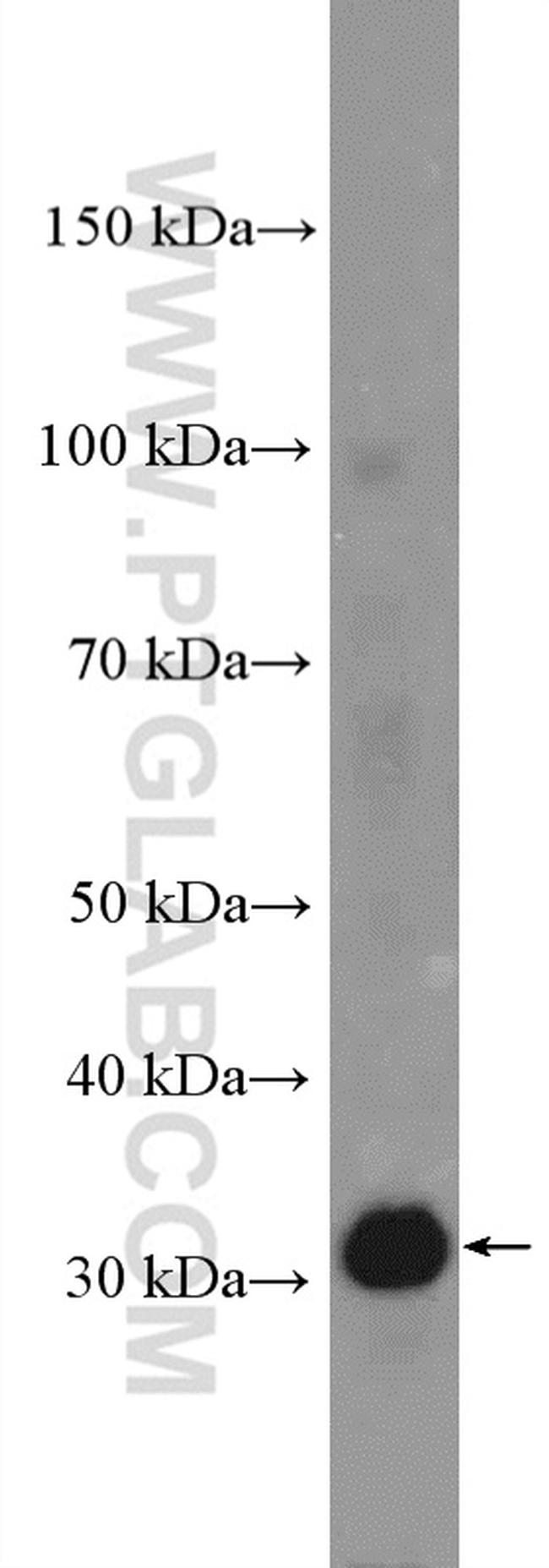 PRPS2 Antibody in Western Blot (WB)