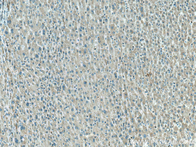 LPIN1 Antibody in Immunohistochemistry (Paraffin) (IHC (P))