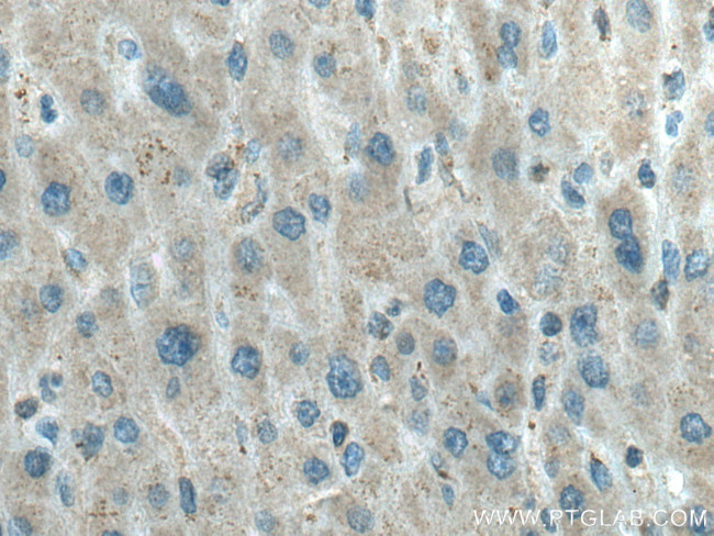 LPIN1 Antibody in Immunohistochemistry (Paraffin) (IHC (P))