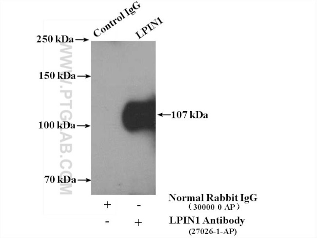 LPIN1 Antibody in Immunoprecipitation (IP)