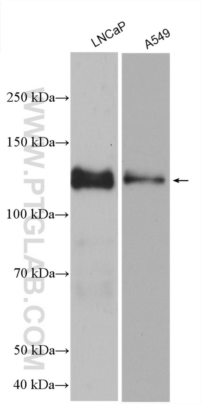 LPIN1 Antibody in Western Blot (WB)