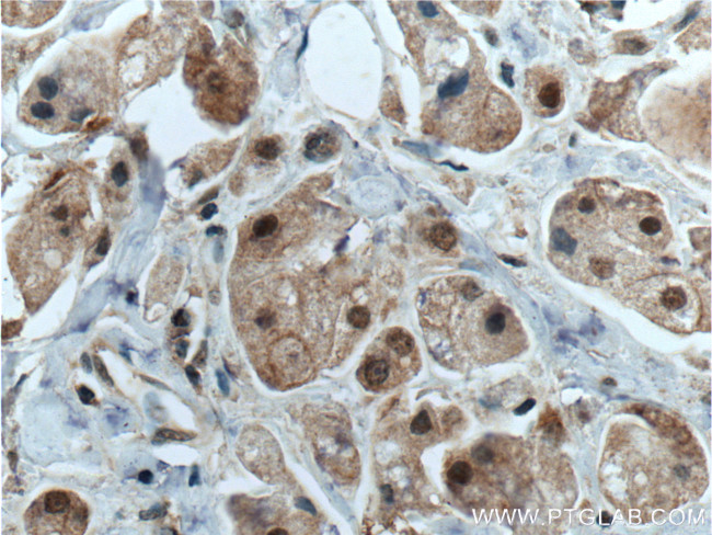 CDK7 Antibody in Immunohistochemistry (Paraffin) (IHC (P))