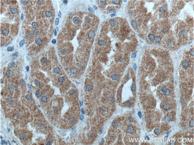 PI 3 Kinase p55 gamma Antibody in Immunohistochemistry (Paraffin) (IHC (P))