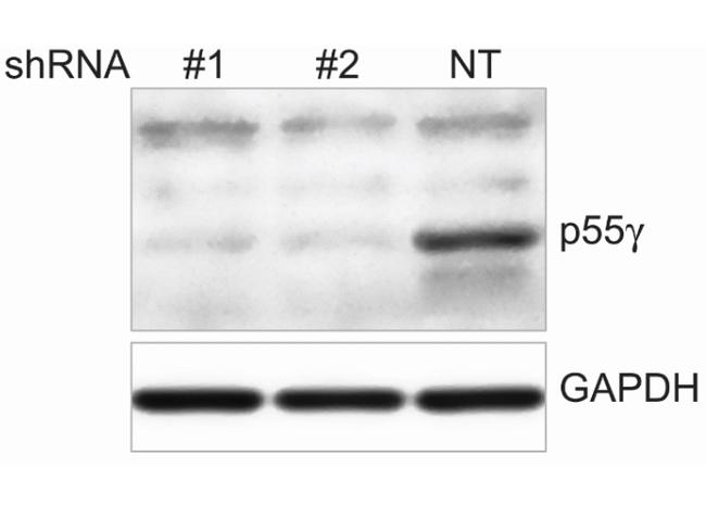 PI 3 Kinase p55 gamma Antibody in Western Blot (WB)