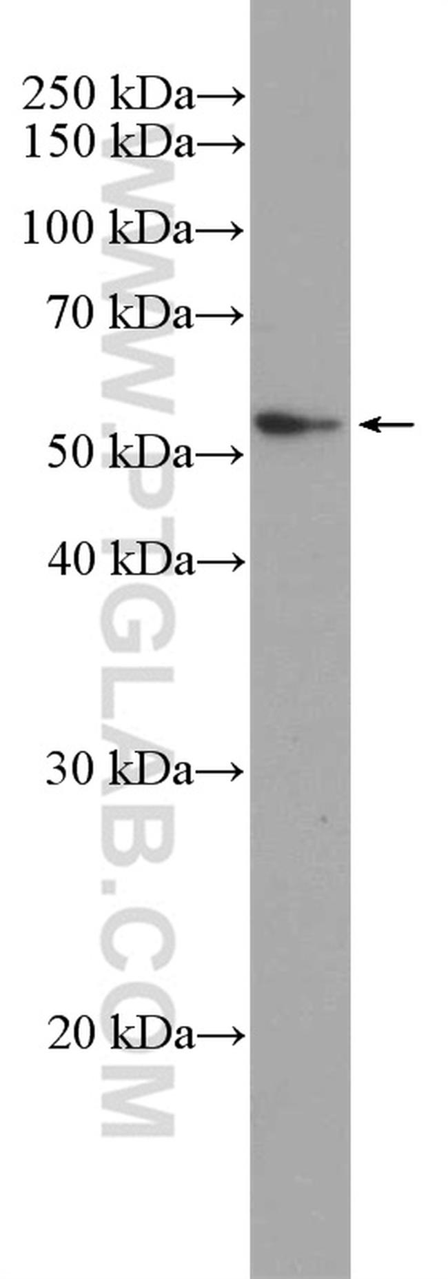 PI 3 Kinase p55 gamma Antibody in Western Blot (WB)