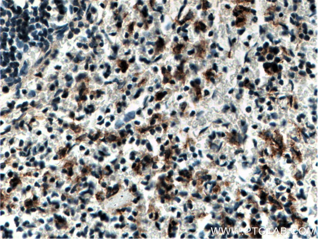 EMR1 Antibody in Immunohistochemistry (Paraffin) (IHC (P))