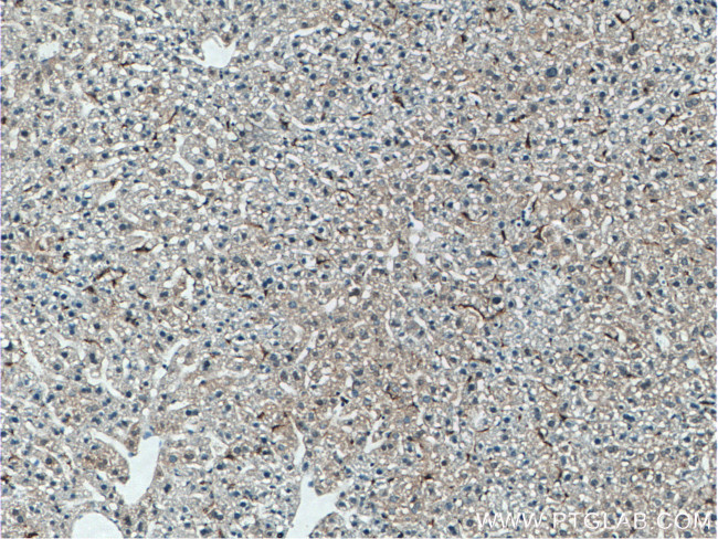 EMR1 Antibody in Immunohistochemistry (Paraffin) (IHC (P))