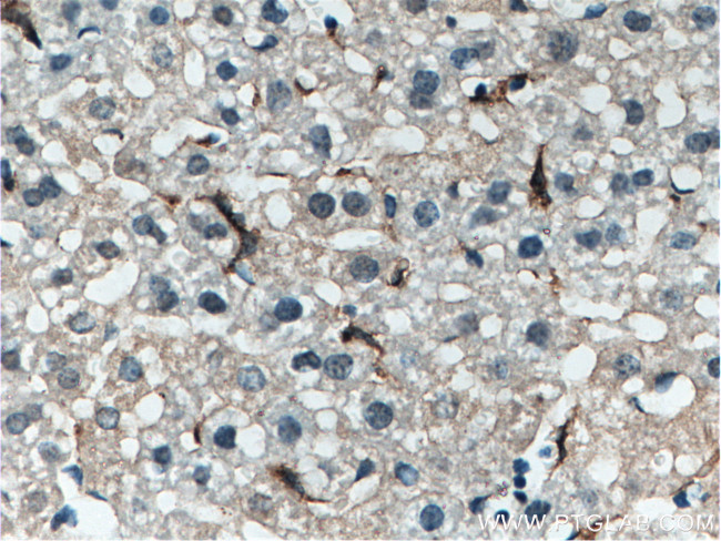 EMR1 Antibody in Immunohistochemistry (Paraffin) (IHC (P))