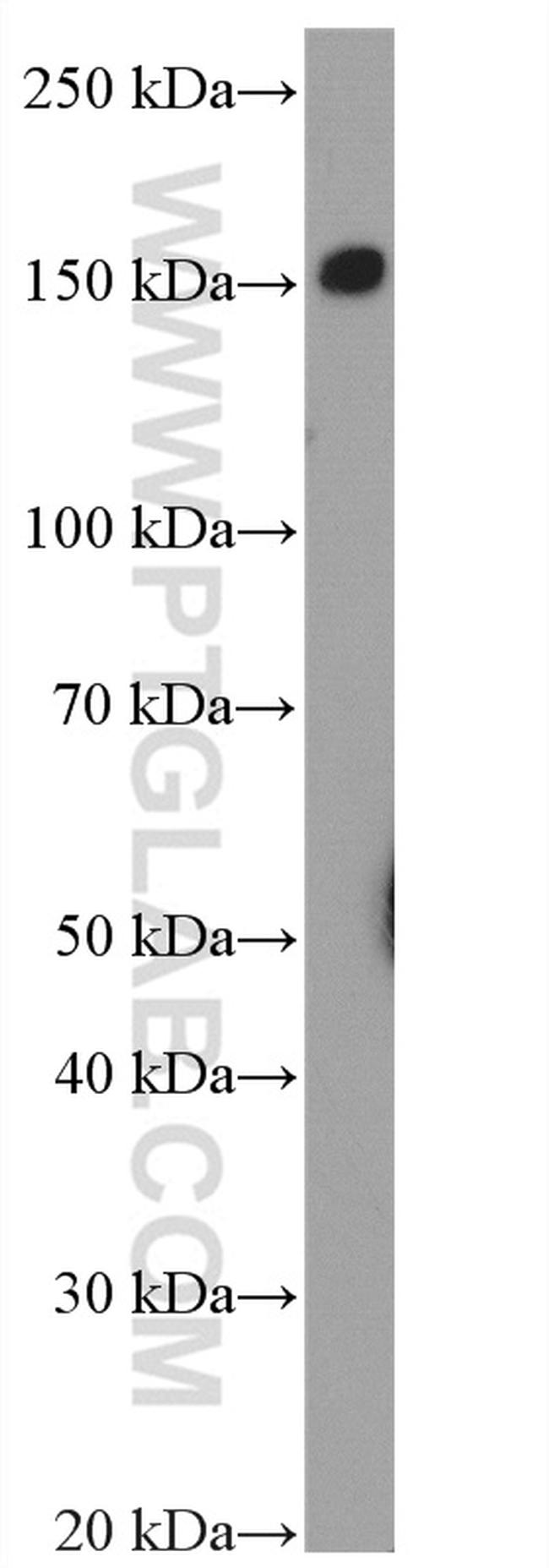 EMR1 Antibody in Western Blot (WB)