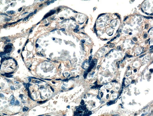 XKRX Antibody in Immunohistochemistry (Paraffin) (IHC (P))