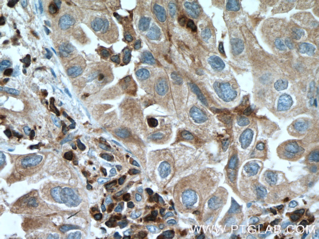 FBP17 Antibody in Immunohistochemistry (Paraffin) (IHC (P))