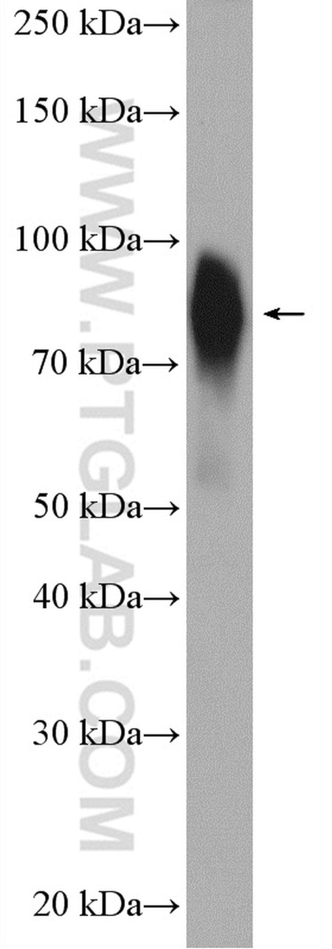 FBP17 Antibody in Western Blot (WB)