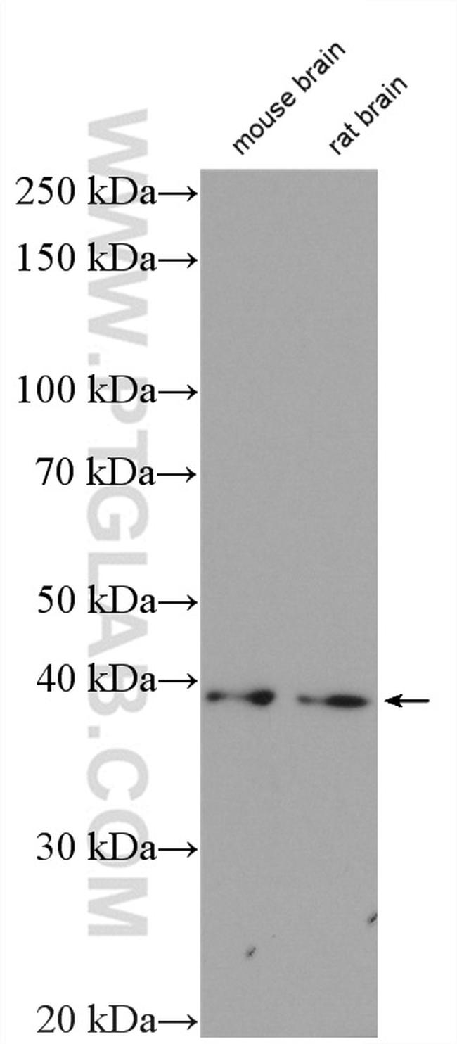 CDK5R2/p39 Antibody in Western Blot (WB)